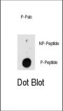 Integrin-Linked Protein Kinase Phospho-Thr173 (ILK pT173) Antibody