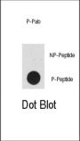 p53 (pT55) Antibody