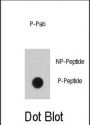 EGFR (pY1016) Antibody