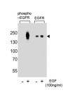 EGFR (pY1016) Antibody