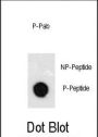 GATA6 (pY271) Antibody