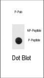 TERT (pS1125) Antibody