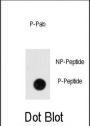 ANTXR1 (pY382) Antibody