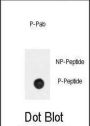 BAR2 (phospho-Ser261) Antibody