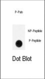 GIT1 (pY554) Antibody