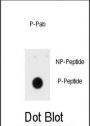 INSR (pY1185) Antibody