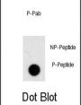 NOMO1 (pS1205) Antibody