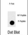Prolactin (pS163) Antibody