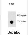 ZBTB16 (pY334) Antibody