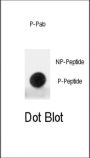 Mdm2 p53 Binding Protein Homolog Phospho-Ser395 (MDM2 pS395) Antibody