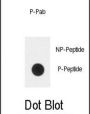 PLXND1 (pY1642) Antibody