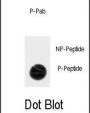 ACK1 (pY518) Antibody