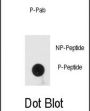 Interferon-Inducible Double-Stranded RNA-Dependent Protein Kinase Activator A Phospho-Ser246 (PRKRA pS246) Antibody