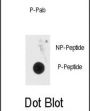 Methyl CpG Binding Protein 2 Phospho-Ser80 (MECP2 pS80) Antibody