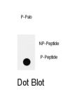 IRS2 (pY978) Antibody