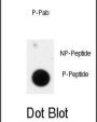 ANTXR1 (pY425) Antibody