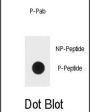 ERK1/2 (phospho-Thr202/Tyr204) Antibody