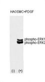 ERK1/2 (phospho-Thr202/Tyr204) Antibody