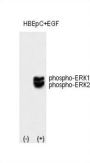 ERK1/2 (phospho-Thr202/Tyr204) Antibody