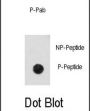 CDK2 (pT14) Antibody