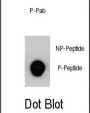 MUC1 (pY1229) Antibody