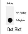 HIPK2 (pY361) Antibody