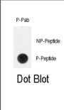 TERT (pY707) Antibody