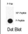 FABP4 (pY20) Antibody