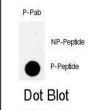 TBK (pS172) Antibody