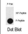 Claudin 2 (pY224) (CLDN2) Antibody