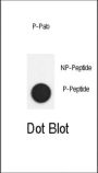 SMAD2 (phospho-Ser118) Antibody