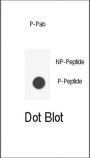 IL6ST (pY905) Antibody