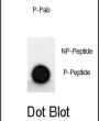 MAP2 (pS1539) Antibody