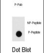 Endophilin (pY80) Antibody