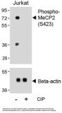 Methyl CpG Binding Protein 2 Phospho-Ser423 (MECP2 pS423) Antibody