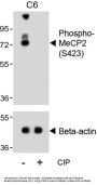 Methyl CpG Binding Protein 2 Phospho-Ser423 (MECP2 pS423) Antibody