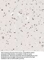 Methyl CpG Binding Protein 2 Phospho-Ser423 (MECP2 pS423) Antibody