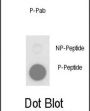 PLB (pT17) Antibody