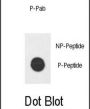 E2F1 (pS364) Antibody