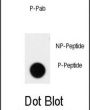 ACK1 (pY826) Antibody