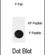 NFKBIA (pSer32) Antibody