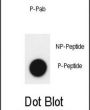 JMJD2A (pY547) Antibody