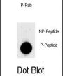LIN28 (pS134) Antibody