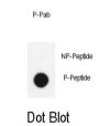 LIMK1 (pT508) Antibody