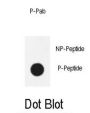 NFkB (phospho-Ser536) Antibody