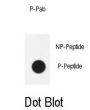 RAC-Alpha Serine/threonine-Protein Kinase Phospho-Thr450 (AKT1 pT450) Antibody