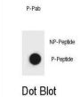 Belcin 1 (p119) Antibody