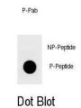 YAP (phospho-Ser127) Antibody