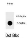 Platelet-Activating Factor Acetylhydrolase IB Subunit Beta (PAFAH1B2) Antibody