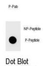 TOPBP1 (pS1159) Antibody